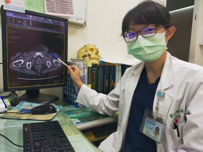 全腹膜外腹腔鏡疝氣手術　老婦術後第二天順利出院