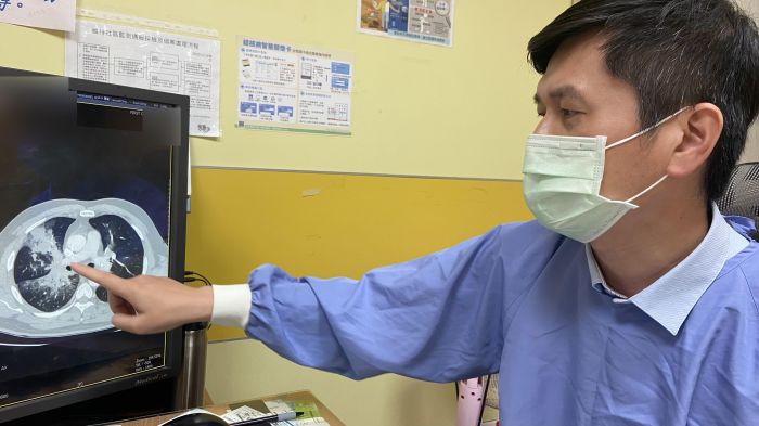 肺癌3期 蒙古男子跨海求診