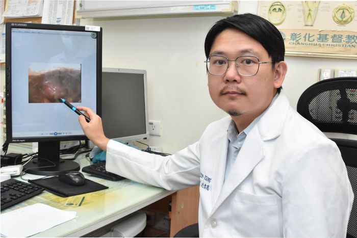 不菸不酒仍要注意 36歲陳先生吞嚥困難罹患下咽癌