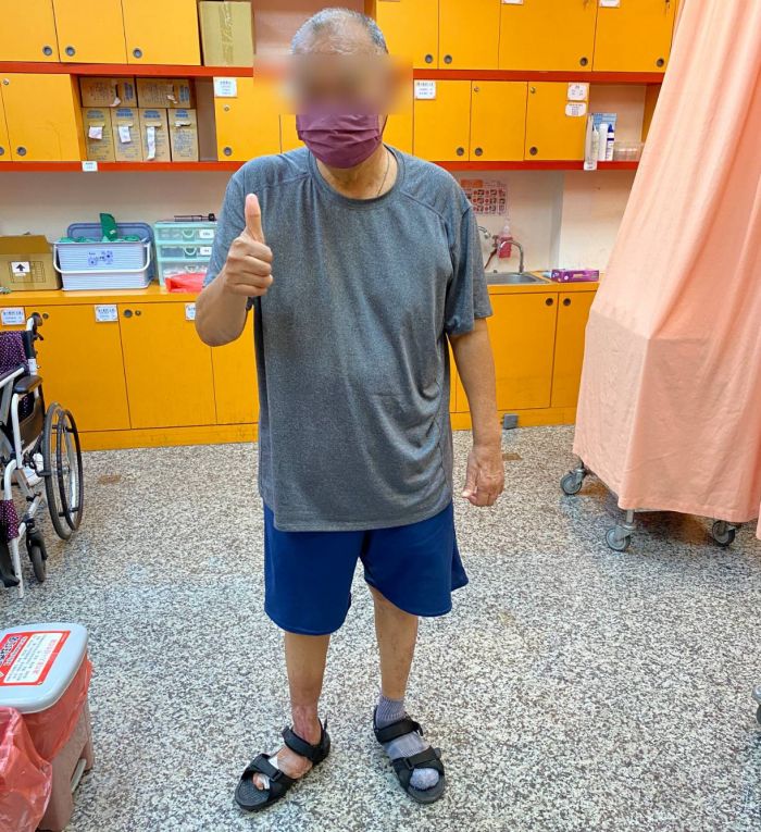 男子患糖尿病足 1元硬幣大傷口險害截肢