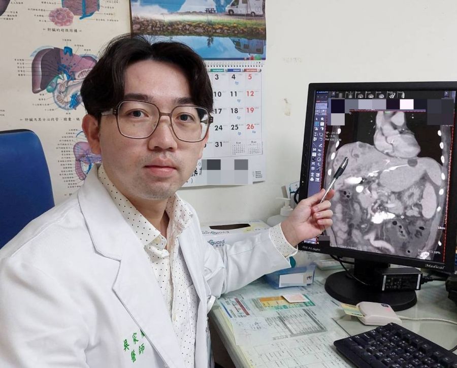 皮膚發黃體重驟降尿色深勿忽視　小心膽管癌悄上身