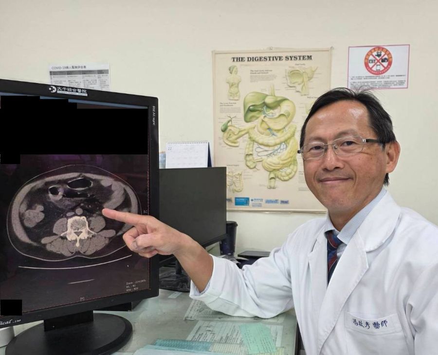 灌腸不當恐致命！ 便秘男子直腸破裂引發嚴重腹膜炎