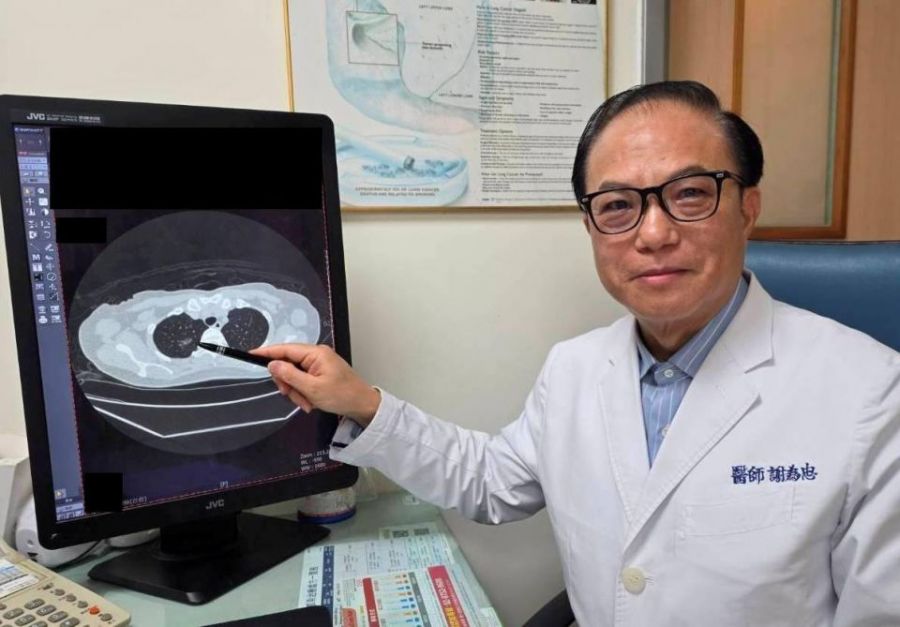 久咳不癒竟藏危機！LDCT助婦人揪出早期肺癌