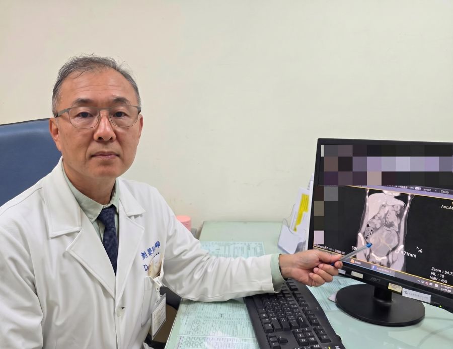 腹脹食慾差竟藏16公分巨瘤  44歲女確診「同步雙癌」